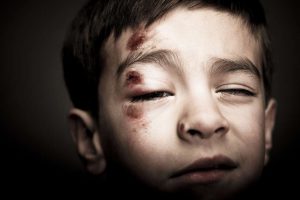 مصادیق کودک آزاری در قوانین ایران